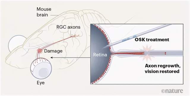 突破科技与医学边界，最新视网膜更换研究取得重要进展
