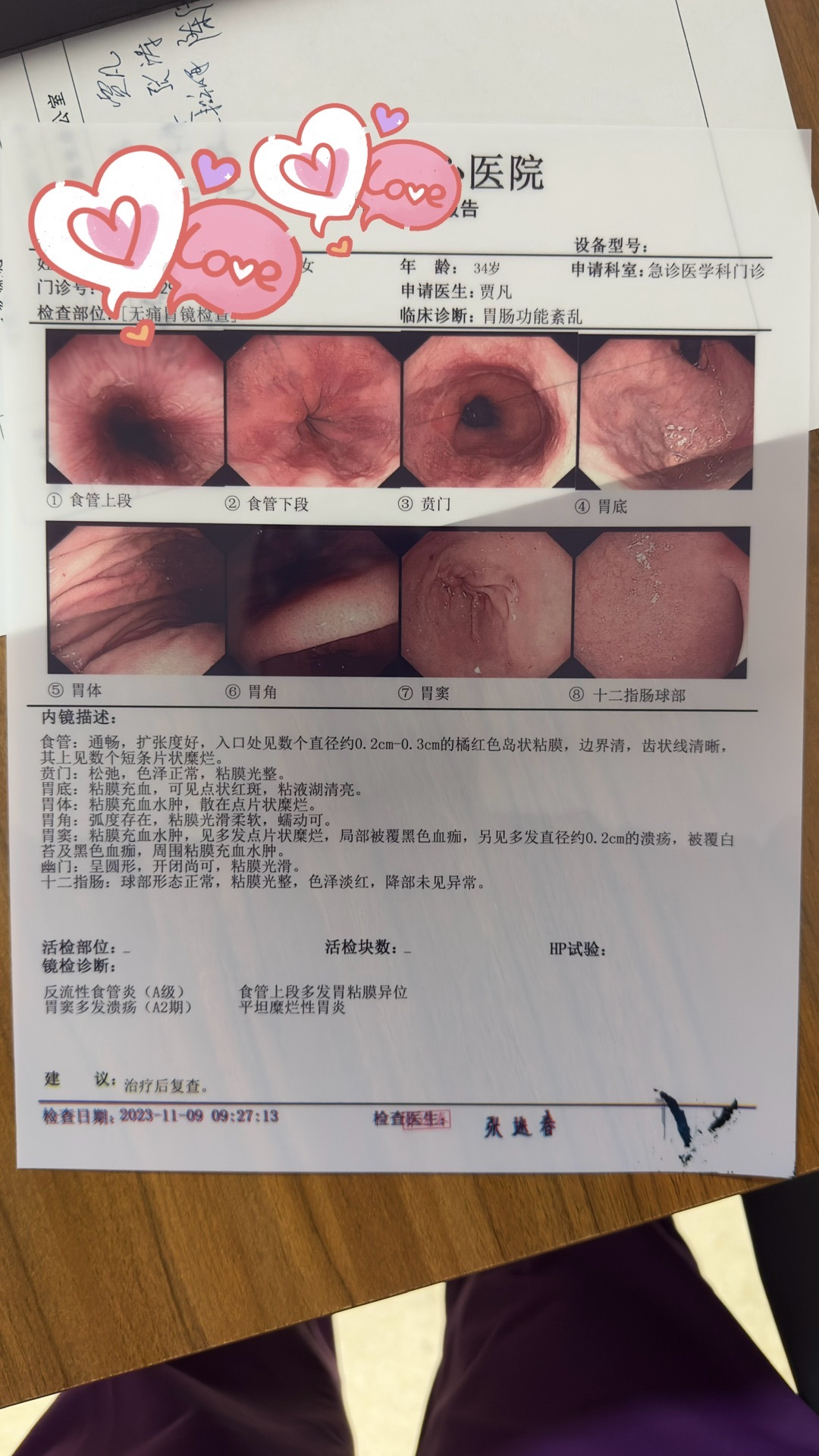 胃最新检查技术引领胃部健康新纪元