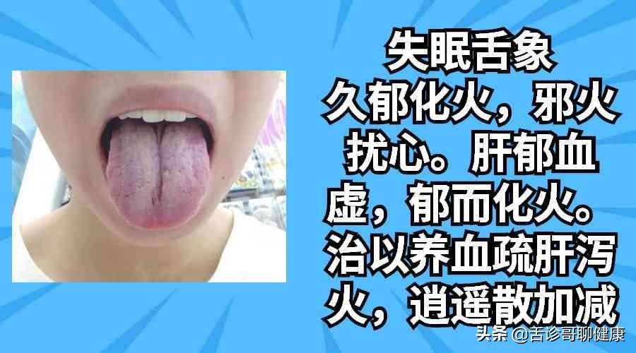 神经哥的新探索与挑战，新时代的先锋引领者