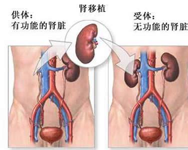 换肾最新贴吧，肾脏移植最新动态与经验分享交流平台